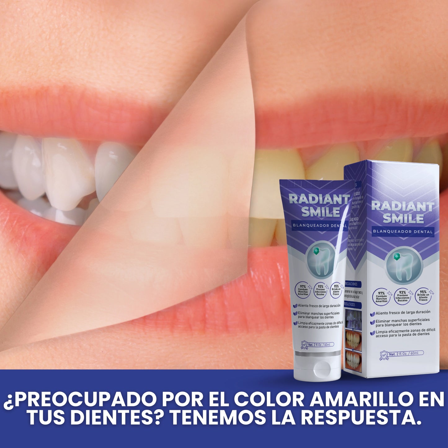 Radiant Smile® (Crema dental blanqueadora)