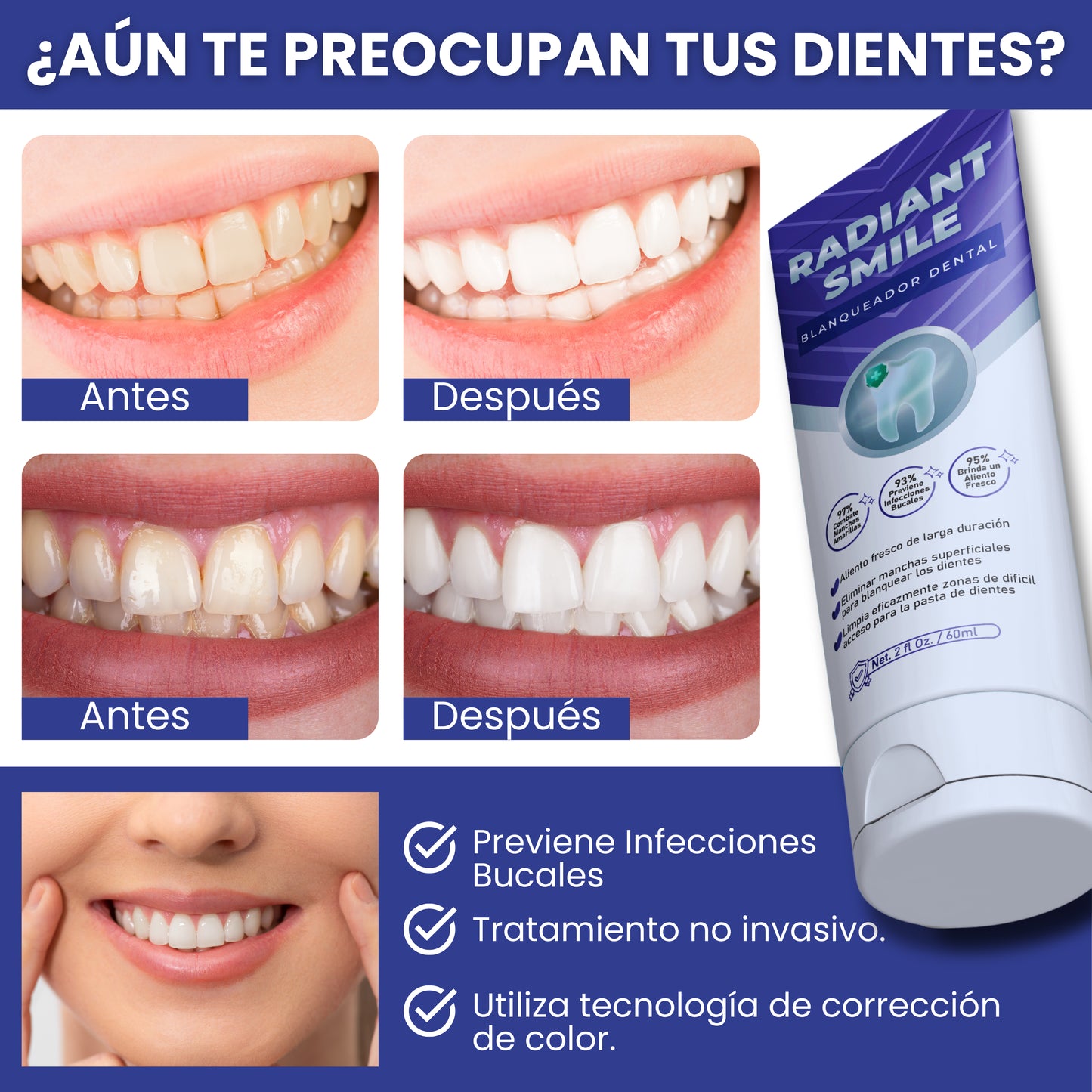 Radiant Smile® (Crema dental blanqueadora)