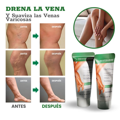 REVITALEGS® - Crema para Eliminar Venas Varices 3.87 fl. Oz