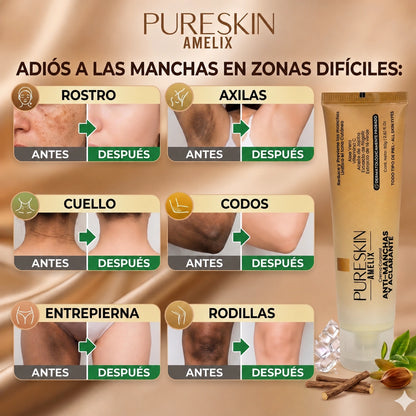 PURESKIN® Crema Antimanchas y Aclarante 2.82 fl. Oz (80g)