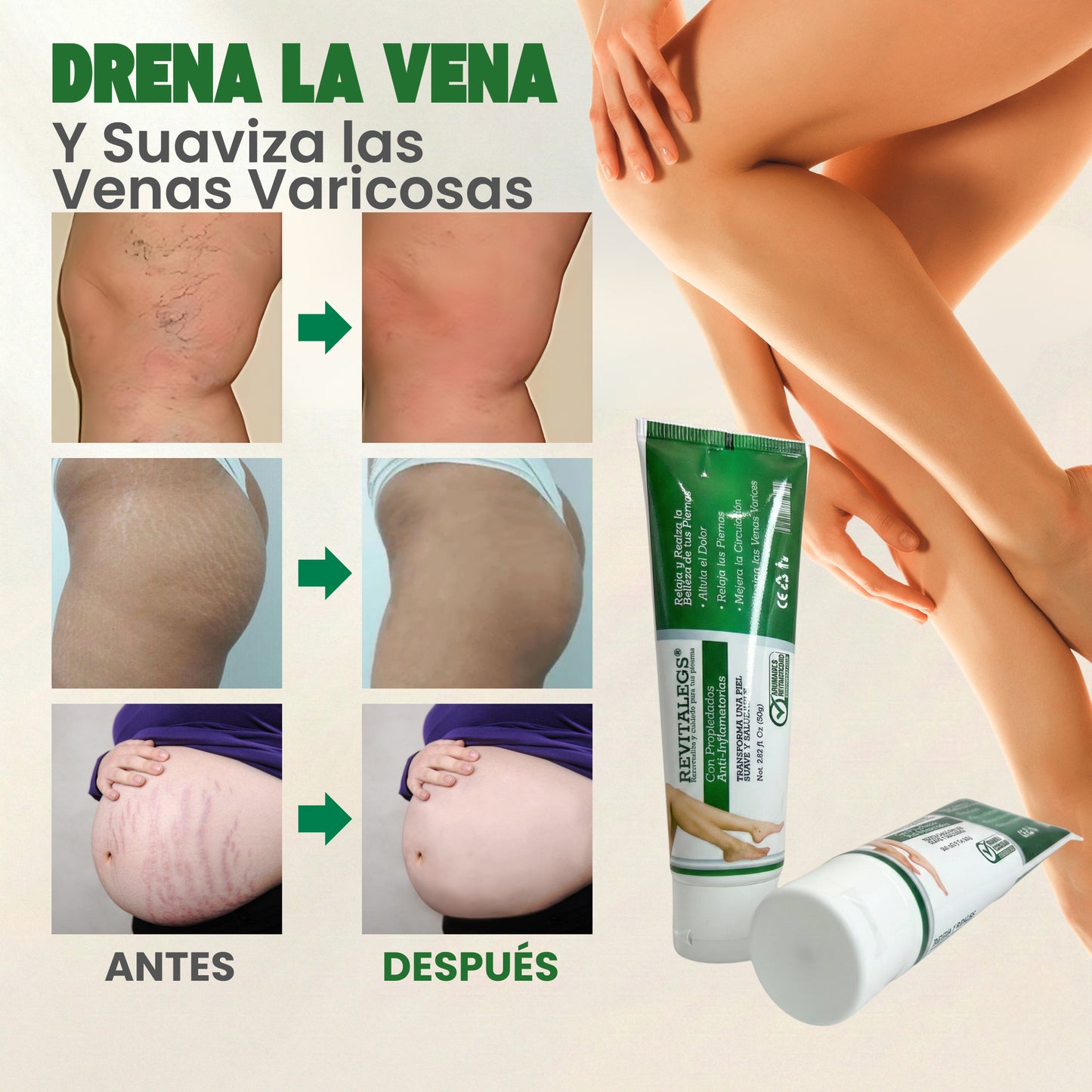 Revitalegs® Crema para Eliminar Venas Varices 2.82 fl. Oz (80g)