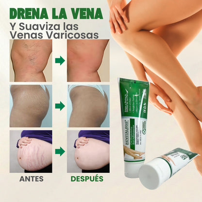 Revitalegs® Crema para Eliminar Venas Varices 2.82 fl. Oz (80g)