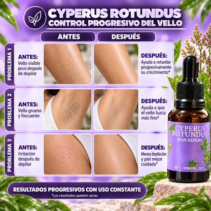 Cyperus Rotundus® Serum *30ml