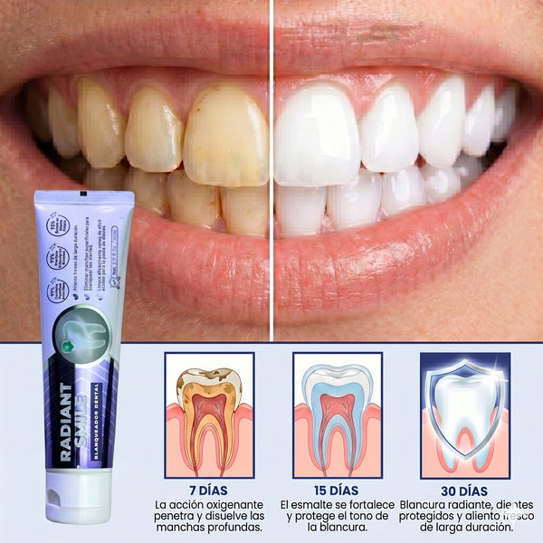 Radiant Smile® (Crema dental blanqueadora)