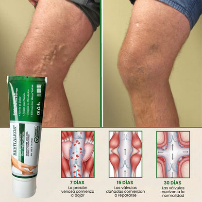 Revitalegs® Crema para Eliminar Venas Varices 2.82 fl. Oz (80g)