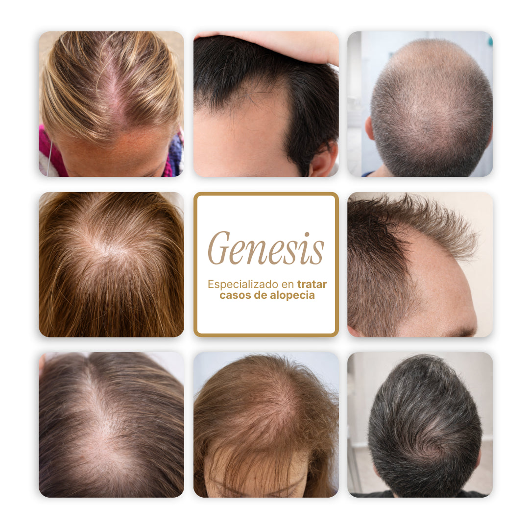 Genesis® Tratamiento intensivo de regeneración capilar 3.38 fl. Oz