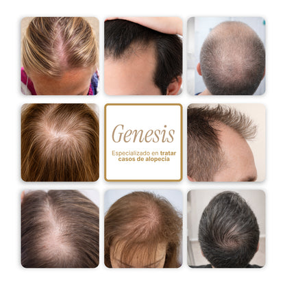 Genesis® Tratamiento intensivo de regeneración capilar 3.38 fl. Oz