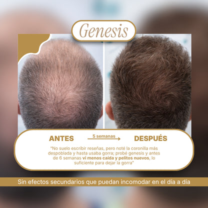 Genesis® Tratamiento intensivo de regeneración capilar 3.38 fl. Oz