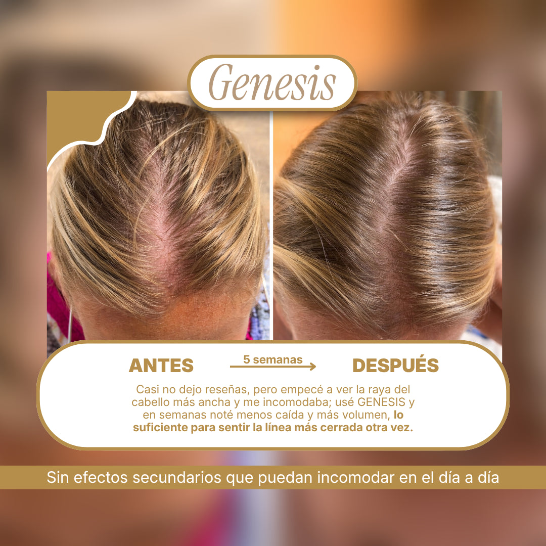 Genesis® Tratamiento intensivo de regeneración capilar 3.38 fl. Oz