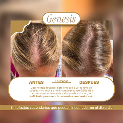 Genesis® Tratamiento intensivo de regeneración capilar 3.38 fl. Oz