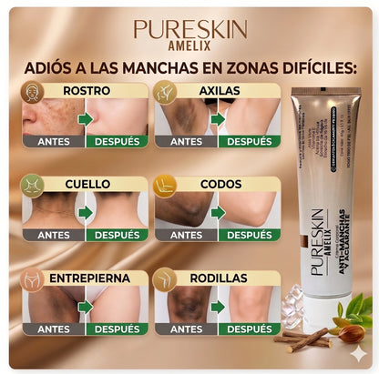 PURESKIN® Crema Antimanchas y Aclarante 2.12 fl. Oz (60g)